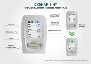СКЭНАР-1-НТ (исполнение 01)  в Рубцовске купить Медицинская техника - denasosteo.ru 